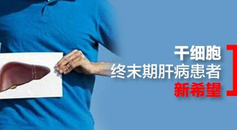 干细胞治疗为终末期肝病患者带来新希望
